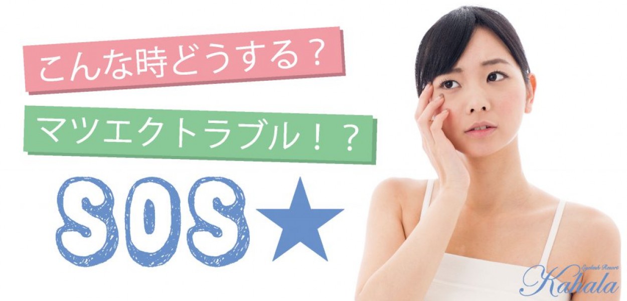 こんな時どうする？マツエクトラブル！？ＳＯＳ★